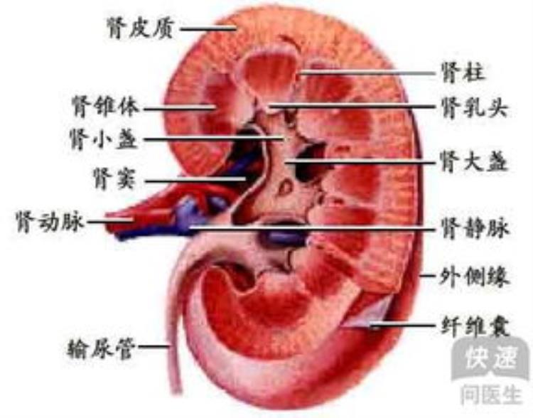 尿出来肾结石,尿液是否会溶解肾结石