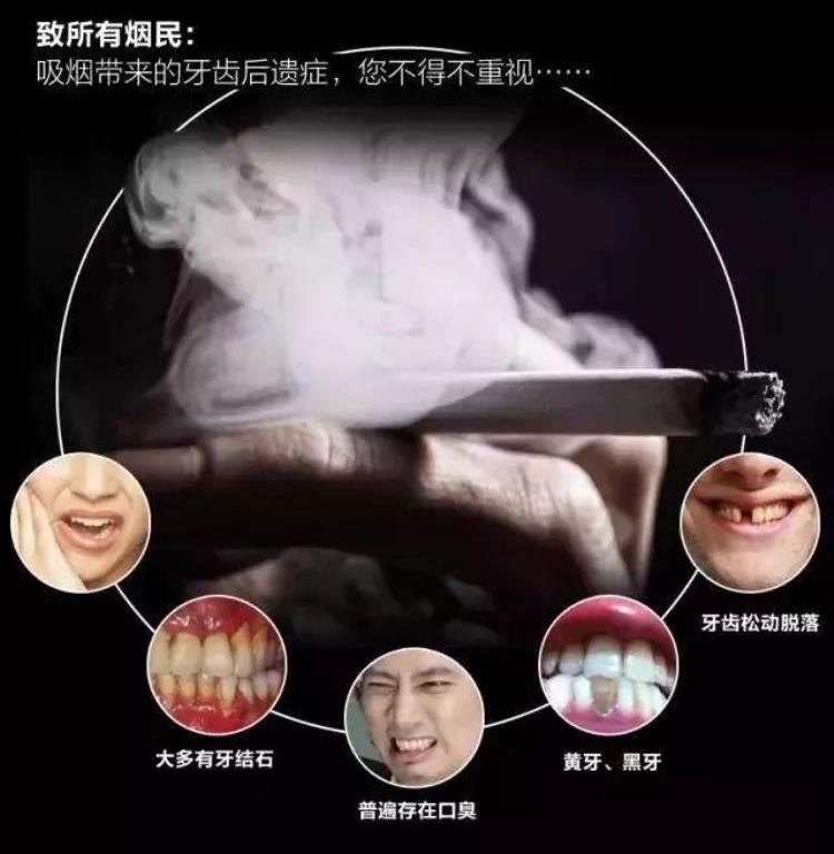 新西兰 牙膏,有什么不伤害牙齿的牙膏