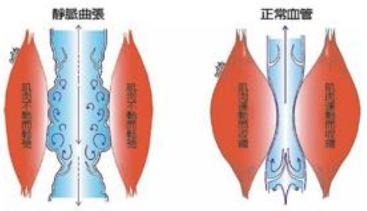 肌肉不锻炼会退化吗,肌肉松弛怎么锻炼能快速恢复