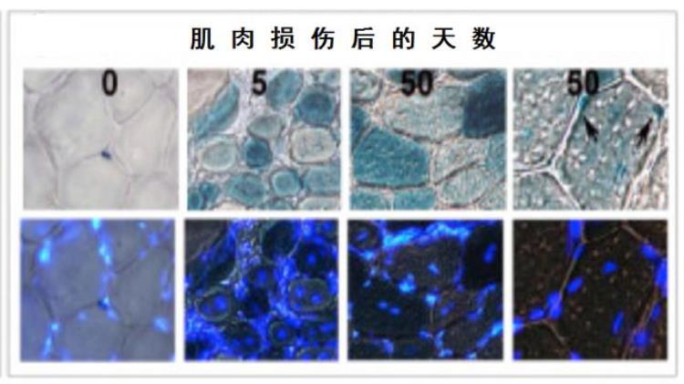 为什么撸铁这类锻炼才能有效增肌增肌的原理是什么