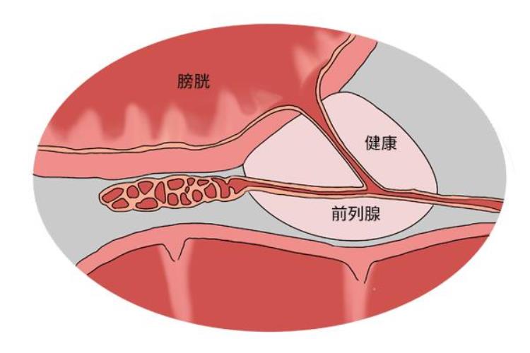 提肛运动有什么好处吗「风靡的提肛运动有何好处别害羞坚持做三大好处不请自来」