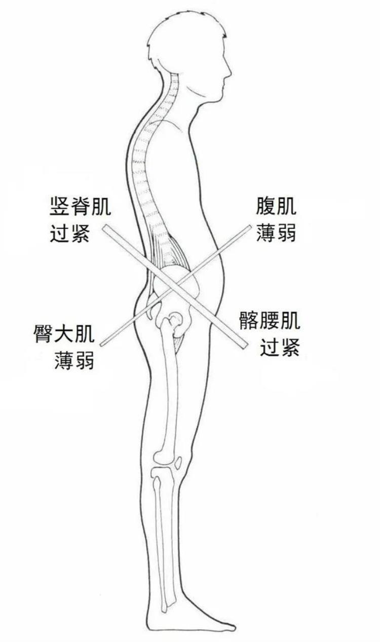 为什么在你练腹肌的时候我也会强调练后腰肌「为什么在你练腹肌的时候我也会强调练后腰肌」