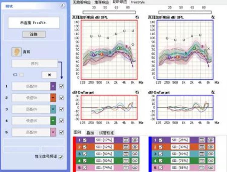 真耳分析仪「真耳分析可不是噱头(上)」