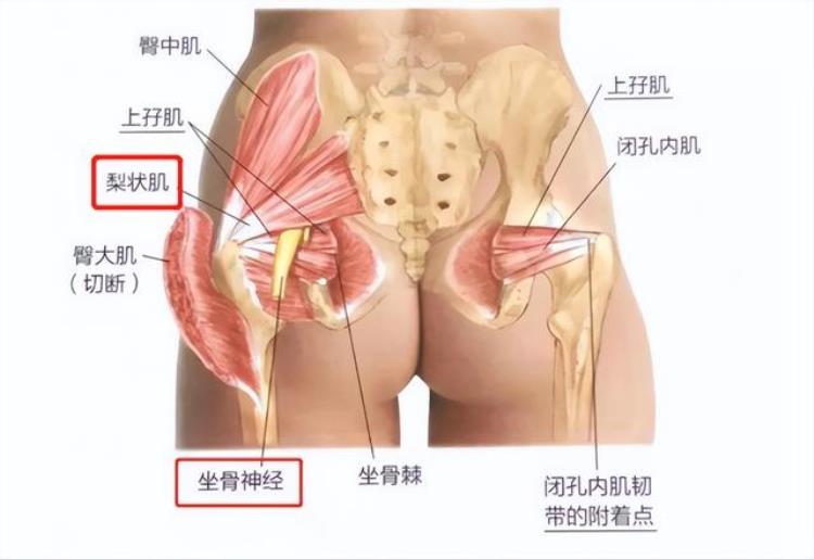 屁股骨头疼走路都疼是怎么回事「一走路屁股就疼怎么回事骨科医生只需2招就能找到病根」