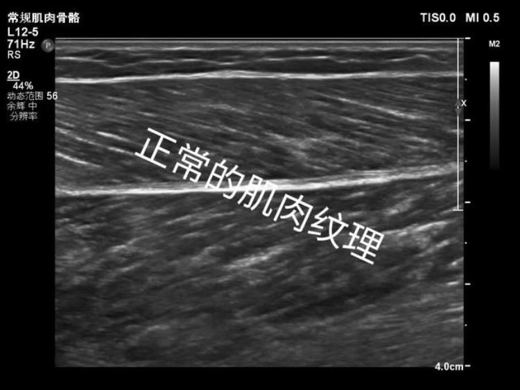 跳绳过程中跳着跳着小腿突然疼了咋回事「跳绳过程中跳着跳着小腿突然疼了咋回事」