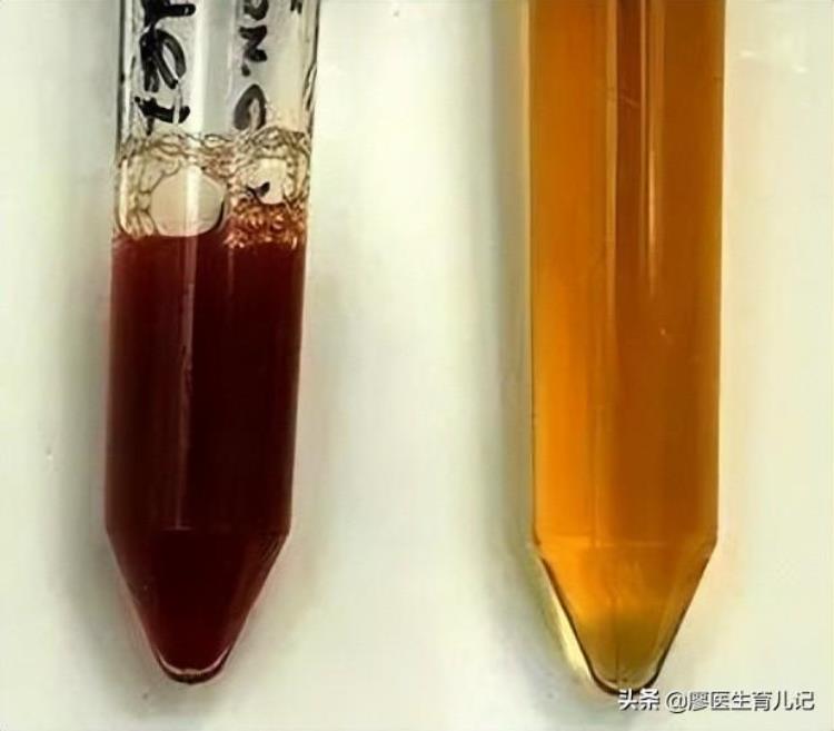 孕期尿液正常颜色「尿液颜色不对孕期实用的尿液颜色小知识都在这里」