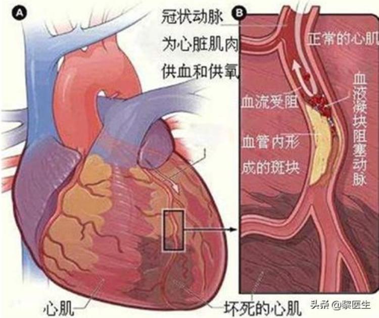 左胸部疼痛是怎么回事女生(左胸部疼痛是怎么回事女生)