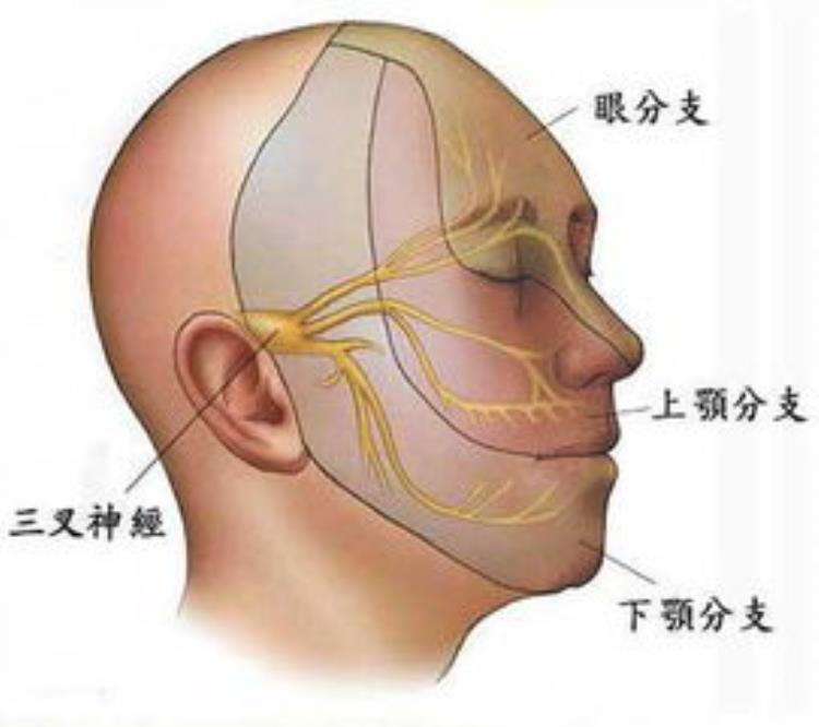 三叉神经痛发作时间是什么时候这篇文章给你讲清楚