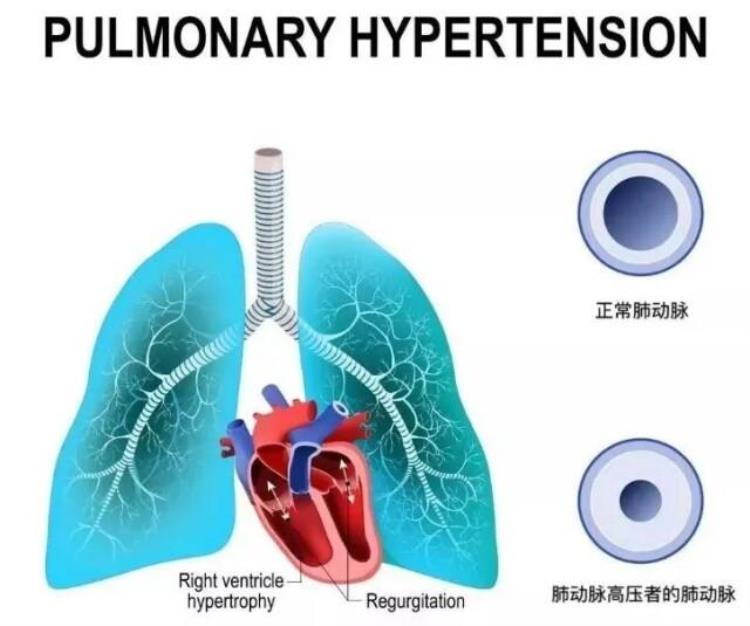 蓝嘴唇是什么病症「孩子哭闹后出现蓝嘴唇需警惕这种致命性疾病」