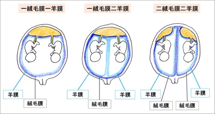 双胞胎是喜还是忧「福祸相依的多胞胎悲与喜就差那么一点点」