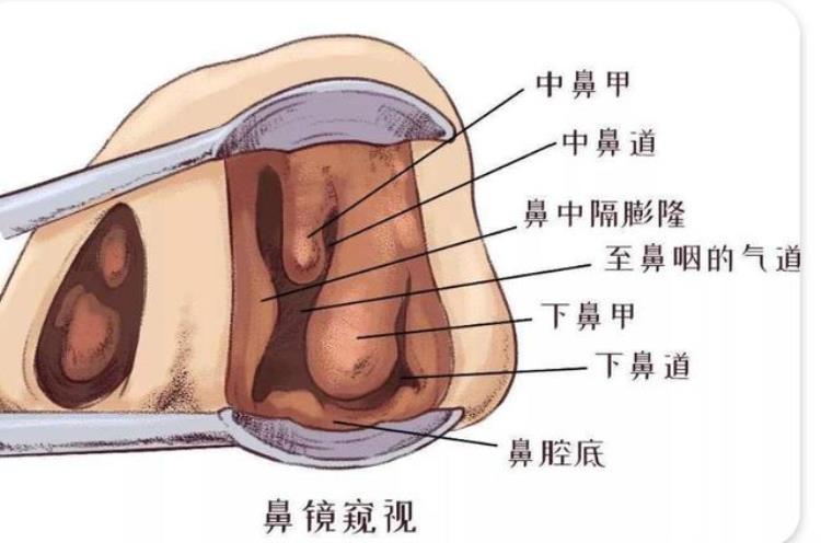 鼻涕倒流引起喉咙很痒有痰「鼻涕倒流导致喉咙有痰痒5招解决鼻涕倒流」