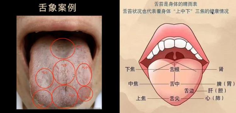 舌诊断五脏六腑健康「舌象分析五脏六腑气多气少怎么分辨看一看舌头就知道了」