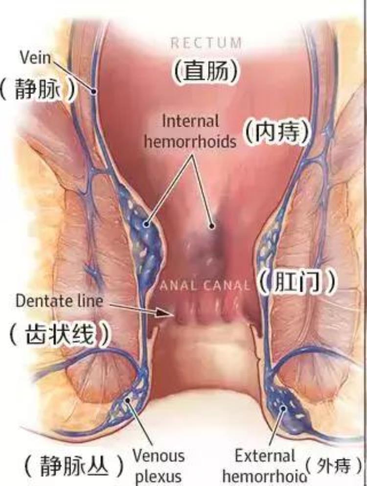 孕妇为什么会得痔疮「孕妇为什么容易得痔疮得了痔疮又该怎么办」