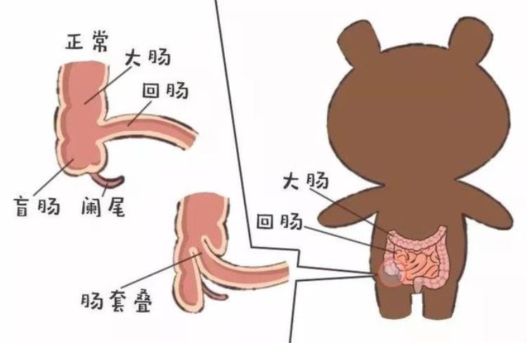 8个月宝宝为何哭闹不止原是TA在作祟宝宝出现这几种症状父母一定要当心