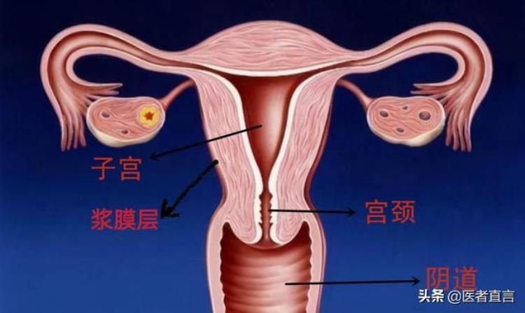 月经不干净带环有什么影响「月经一直不走竟是环惹的祸子宫里的环竟能扎破子宫」