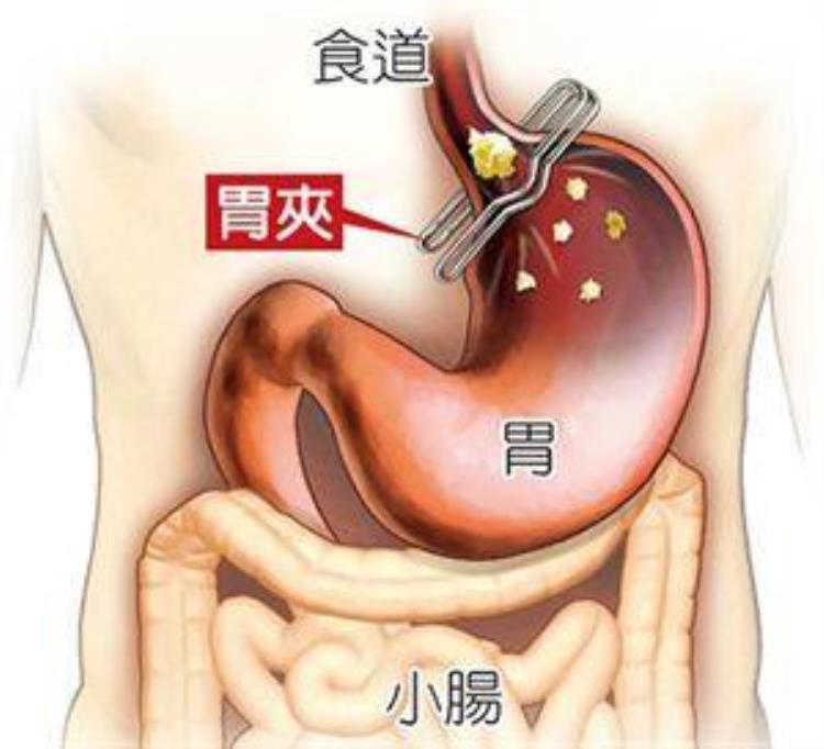 一按肚子就咕噜咕噜的水声「按一下肚子就发出咕咕水声不仅是肠胃不好6种原因须知道」