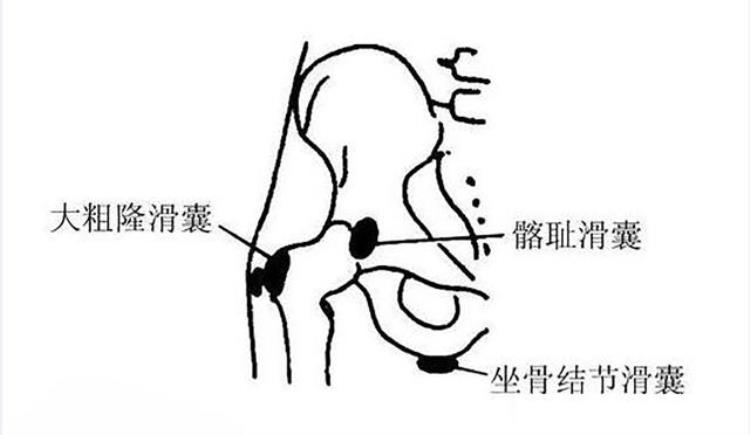 身体有病胯骨知道提醒总是胯骨痛或是这4种病的警报