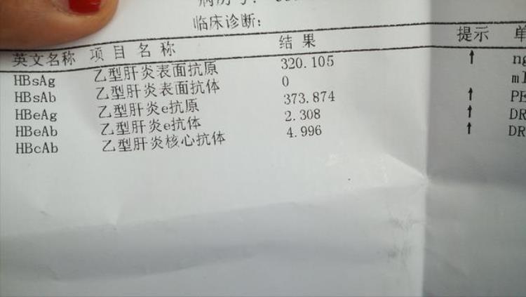 婚检查出来乙肝怎么办,军人婚检女方有乙肝怎么办