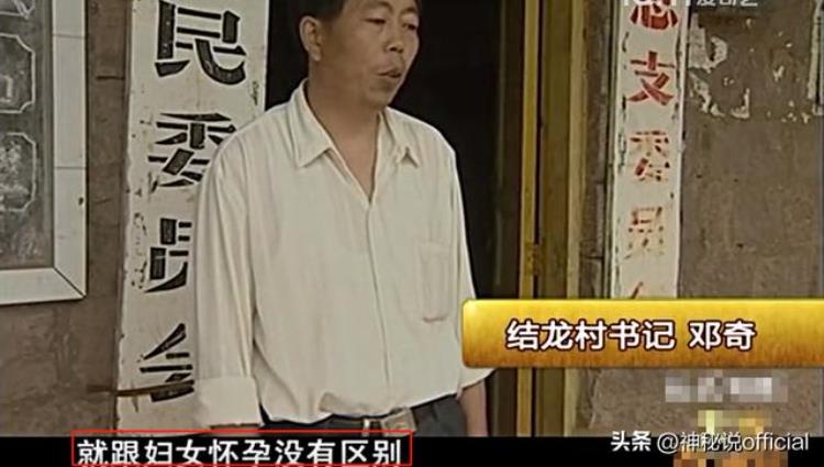 男子肚子大如怀孕,畸胎瘤会导致肚子变大