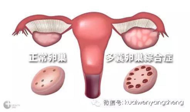 长痘发胖,一年不来月经算闭经吗