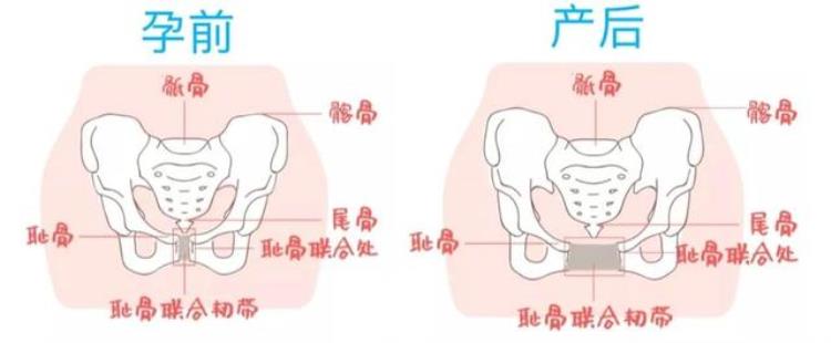 为什么生完宝宝屁股变大了,为什么生完小孩屁股反而小了