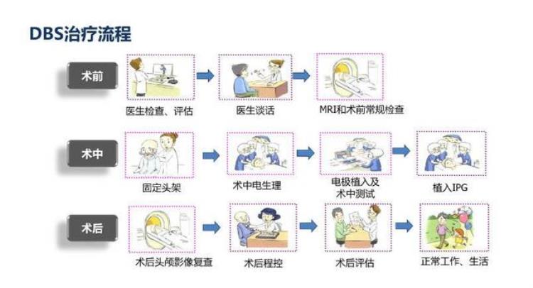 阿凡达电脑「科技有狠活阿凡达的脑机接口还要多久」