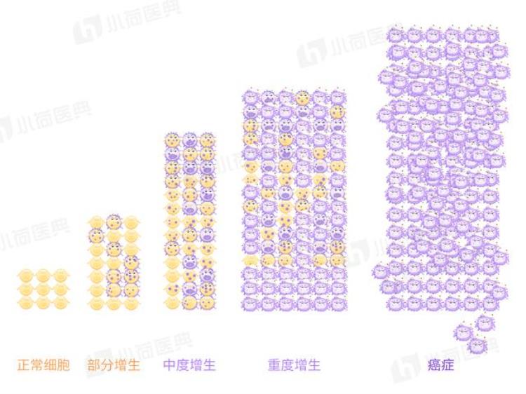 肺癌发病人数和死亡每年多少人「一年82万人发病65万人死亡癌症第一杀手肺癌是如何产生的」