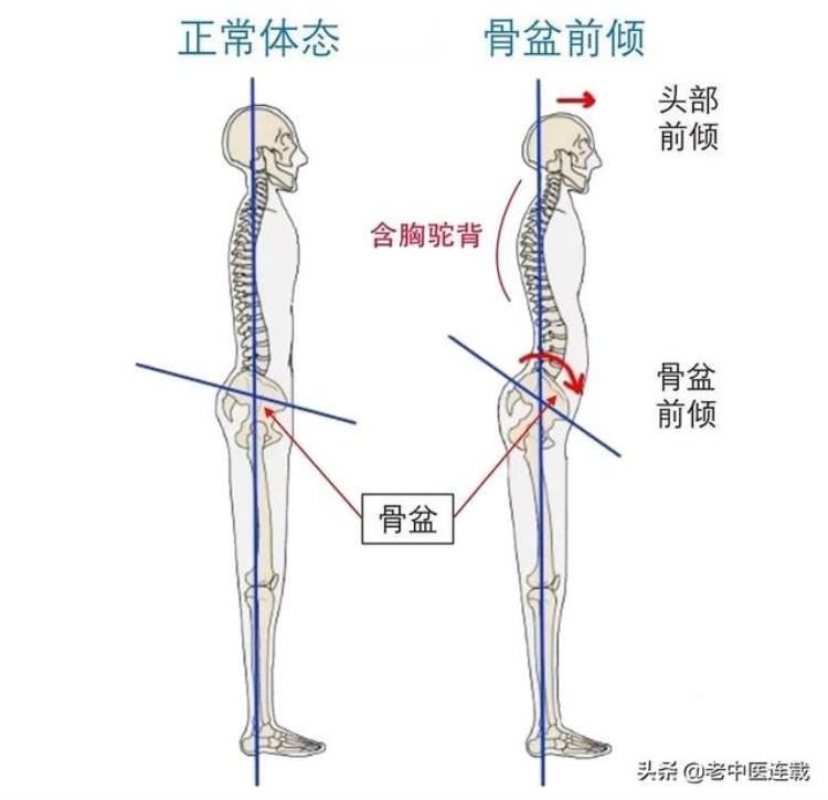 骨盆前倾 迪丽热巴,唐嫣迪丽热巴身高对比