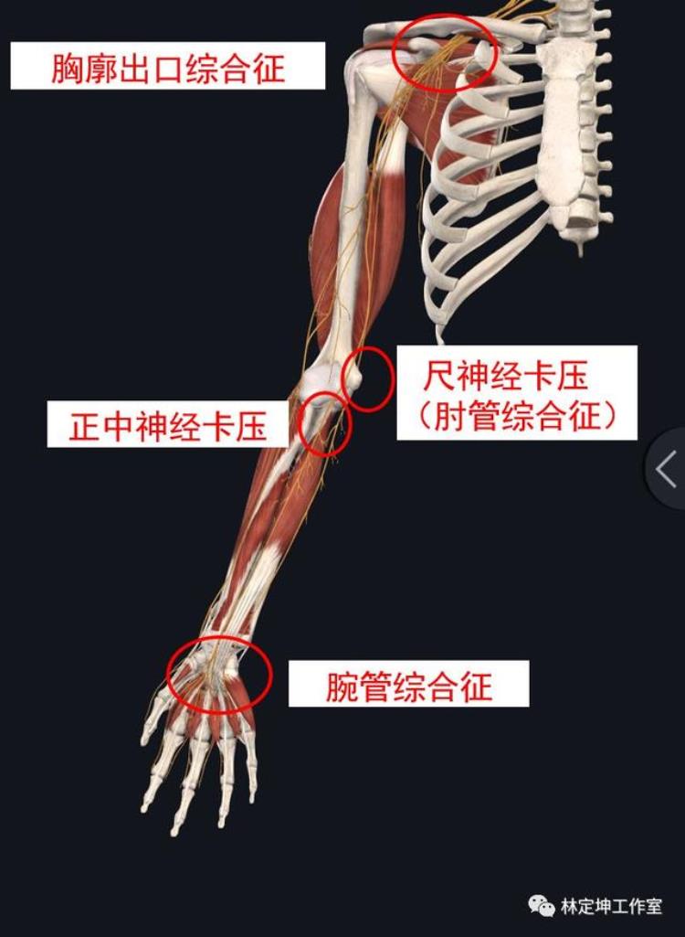 谈骨论筋|手麻手痛除了可能是颈椎病还有可能是