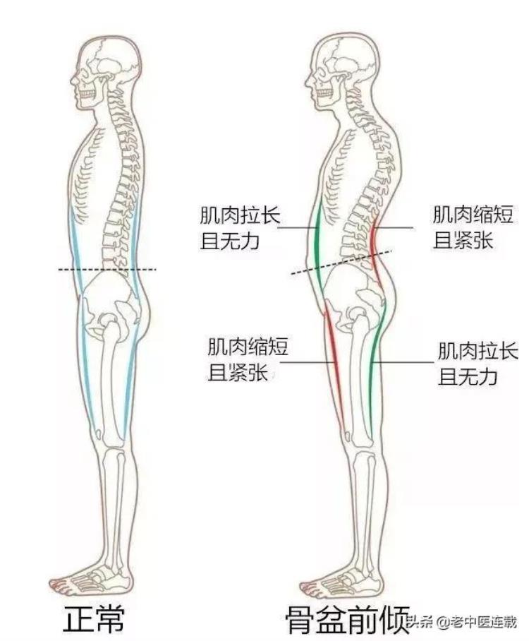 骨盆前倾 迪丽热巴,唐嫣迪丽热巴身高对比