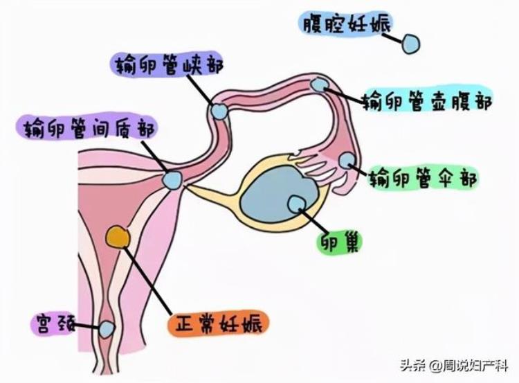 月经没来但小肚子疼,为什么小肚子一直痛月经不来