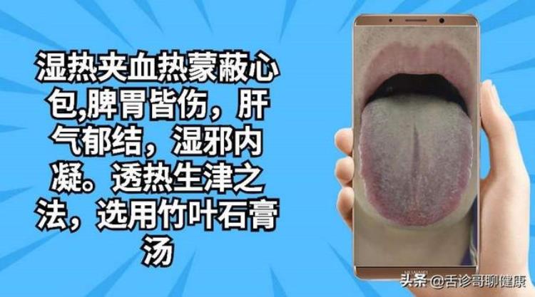 舌头酸和胃有关系吗,舌诊哥