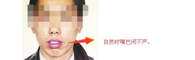 这几种男人面相得注意不能嫁啊建议远离