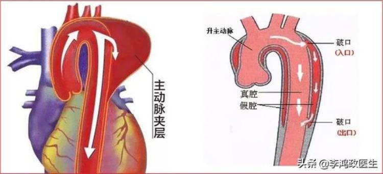 男子腹痛就医后死亡家属拒为其穿寿衣他准备要结婚了