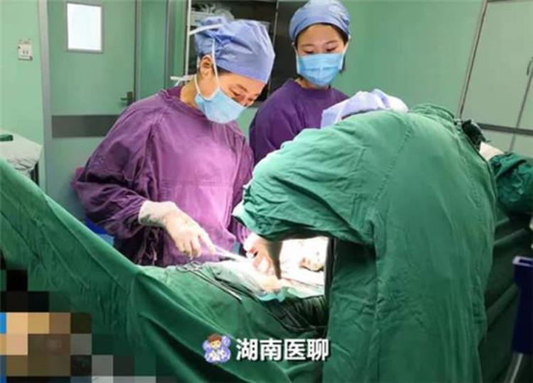 女生怀孕双胞胎以后肚子大了怎么办「女子腹部胀大怀上双胞胎腹痛加剧巧手医生摘除45cm囊肿」