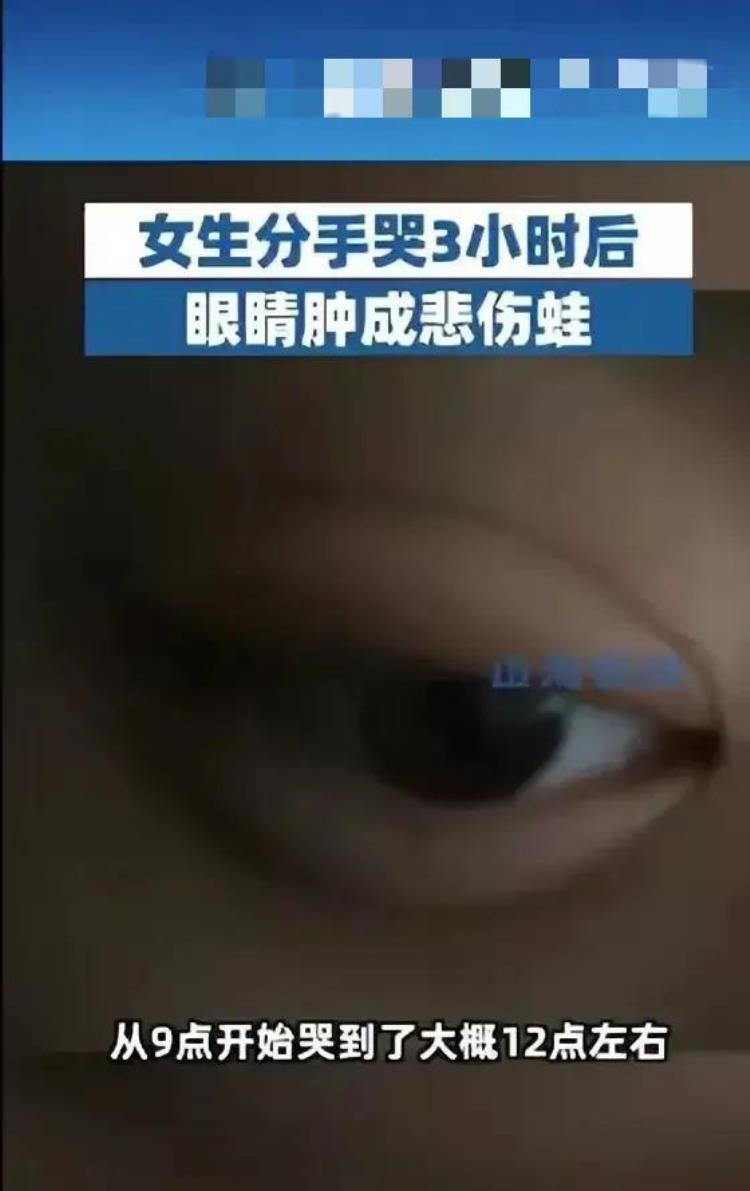 好大的悲伤「好大一只悲伤蛙江苏南京一女生因与男友分手把眼睛给哭肿了」