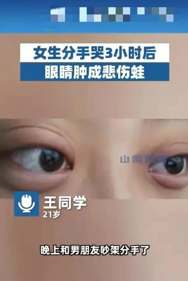 好大的悲伤「好大一只悲伤蛙江苏南京一女生因与男友分手把眼睛给哭肿了」