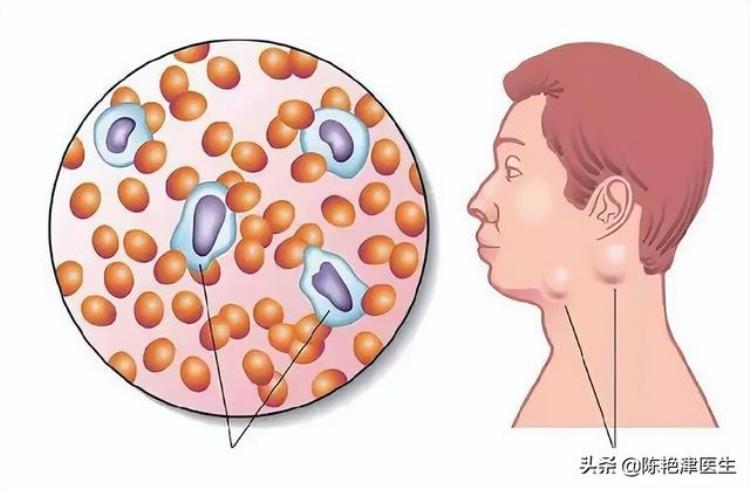 说出汗就出汗是什么毛病「汗液会说话夏天爱出汗或预示4种疾病3个部位汗多要注意」