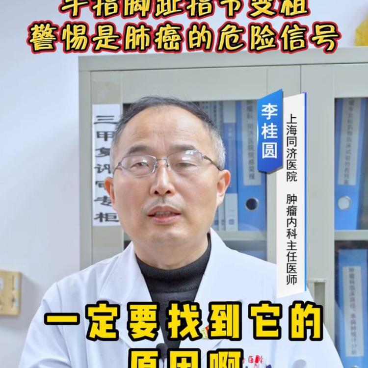 手指关节变粗是肺部出现问题了吗「手指脚趾关节变粗警惕是肺癌的危险信号杵状指」