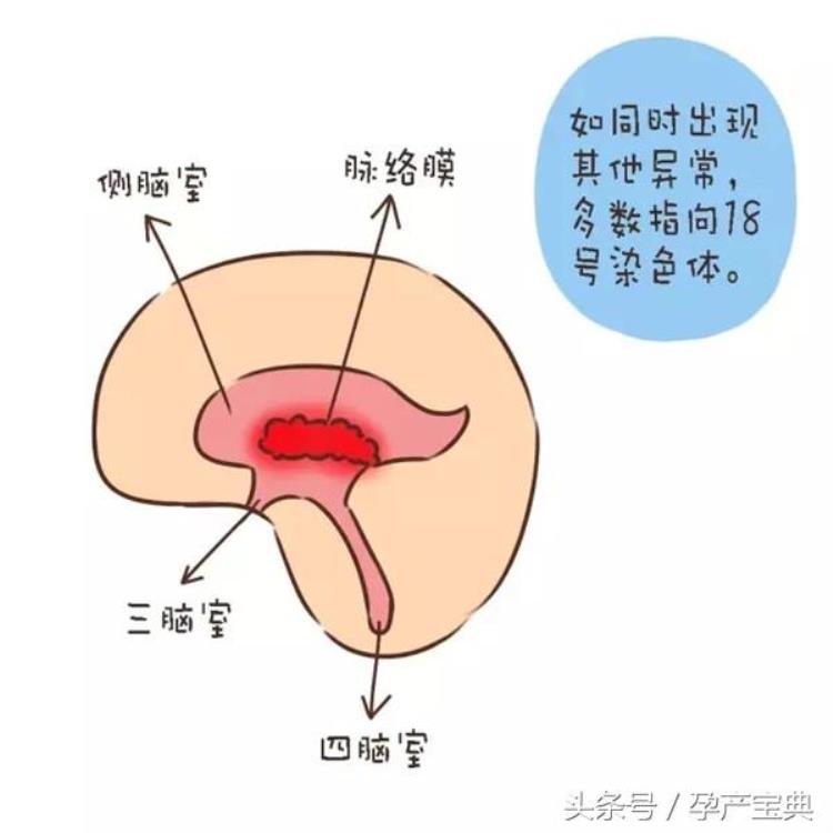 四维彩超显示胎儿心室有强光点「孕期小知识四维彩超发现胎儿心内强光点需要引产吗」