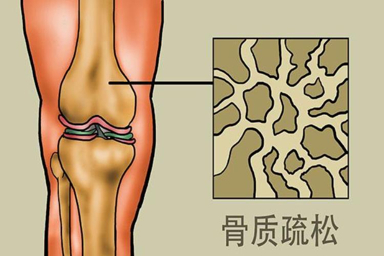 总是感觉腰疼「如果总觉得腰疼可能是什么原因排查6个因素不容小觑」