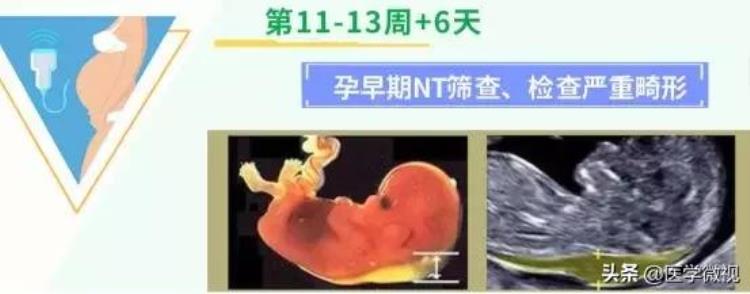 11月份怀孕容易生男孩还是女孩「据说11月可能迎来生娃高峰怀孕后的两种选择你需要了解」