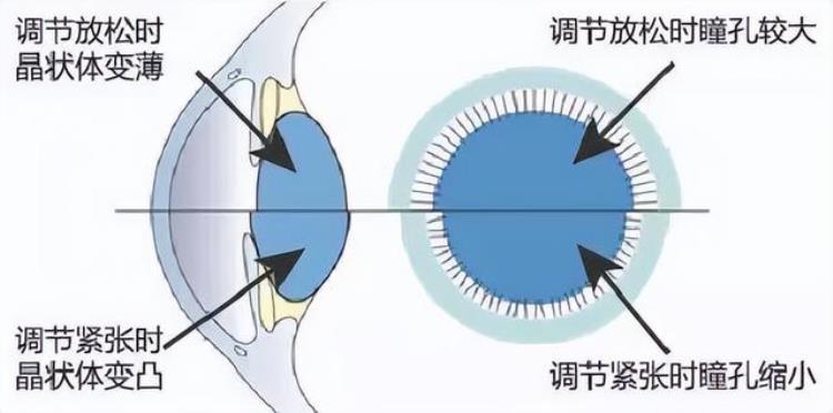 近视激光手术术前检查为什么要散瞳