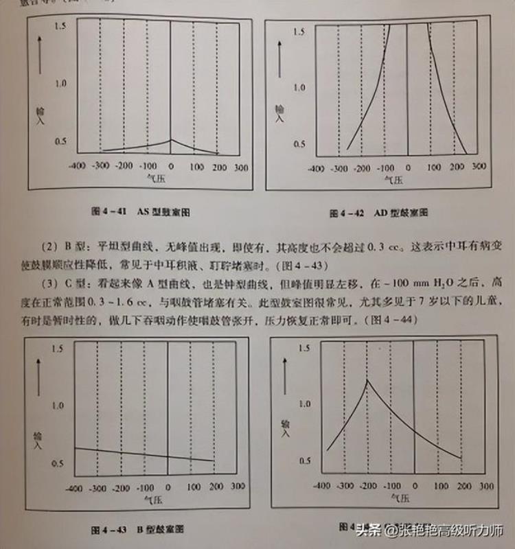 测听力听不到怎么办「听力测试就是测听不听得见大错特错」