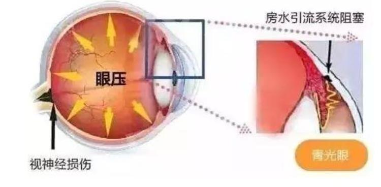 掌眼平台怎么样「掌健识眼压那些事你知道的和你可能不知道的」