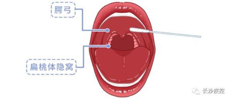 核酸检测为什么不用鼻子「核酸检测为什么要采口鼻不能采耳长沙疾控专家告诉你原因」