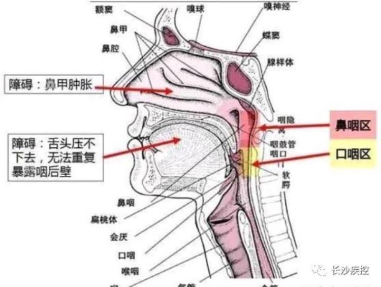 核酸检测为什么不用鼻子「核酸检测为什么要采口鼻不能采耳长沙疾控专家告诉你原因」