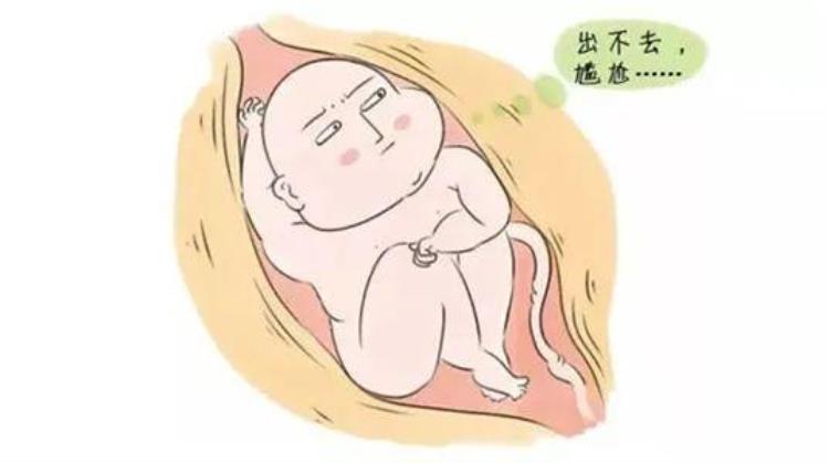 预产期过了就是不生怎么回事「预产期都过了准妈妈还没有生警惕过期妊娠」