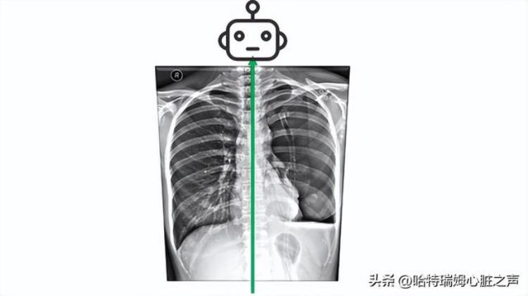 左侧卧睡会压迫心脏?「左侧卧睡觉会压迫心脏哪种睡姿更好」