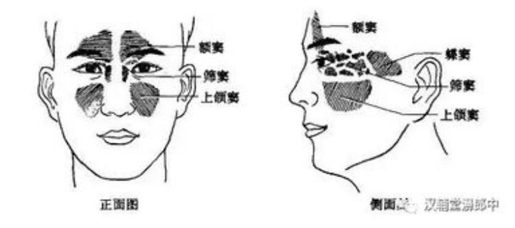 急性鼻窦炎有哪些症状怎么治疗「急性鼻窦炎是什么怎么治疗怎么预防」